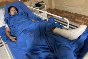 Mamata-Banerjee-Injured1